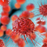 “Low Dose EMFs may cause Severe Health Effects”