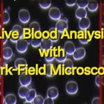 Blood Changes using Cellphone in 3 minutes